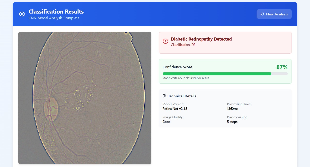 DB Retina preview